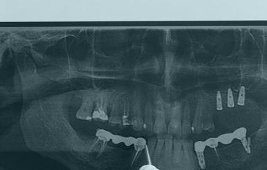 dental-xray-viewed-dentist